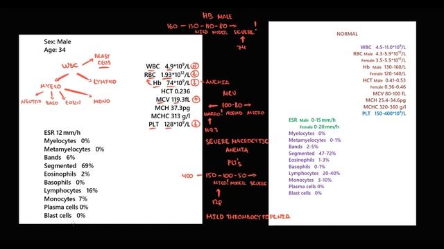 B12 Deficiency & Pernicious Anemia EXPLAINED: Blood Analysis & Differential Diagnosis (High-Yield) смотреть онлайн