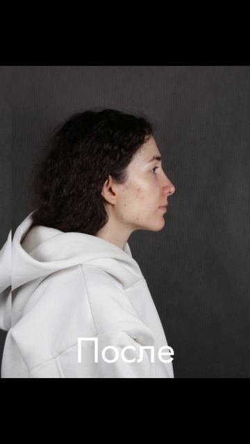 ДО/ПОСЛЕ УСТАНОВКИ ОРТОТИКА смотреть онлайн