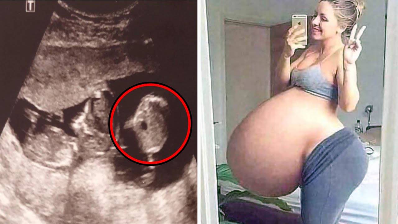 УЗИ этой женщины показало нечто, что потрясло ученых смотреть онлайн