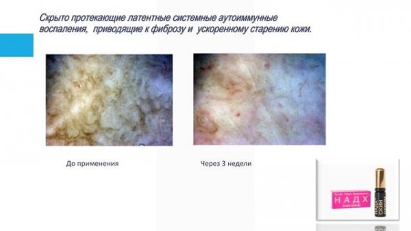 Ревитология. Активное долголетие. Anti-Age