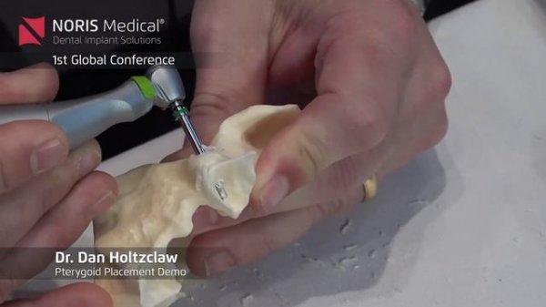 Pterygoid Placement Demo