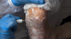 Пилинг-педикюр от ROSILAK