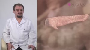 Рекомендации врача _ Сахарный диабет