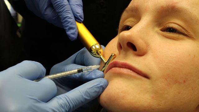 Lip Flip with Botox смотреть онлайн