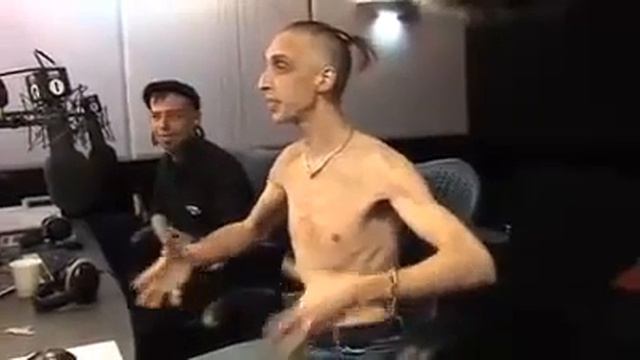 Человек с самой эластичной кожей!ШОК