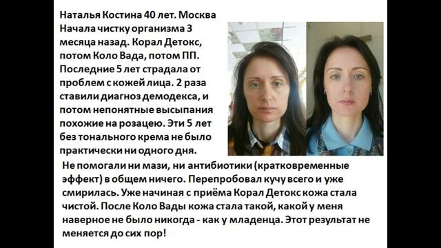 Результат. Демодекс смотреть онлайн