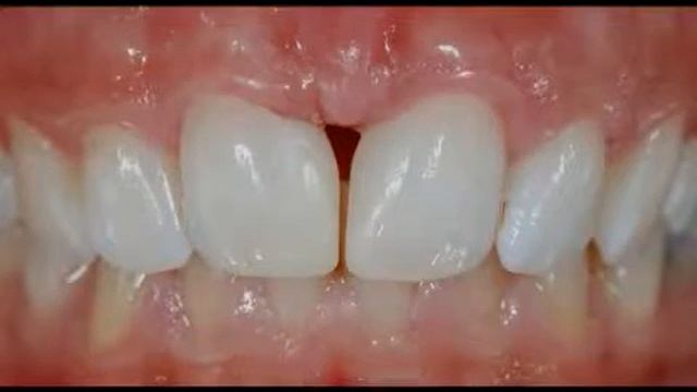 Dr. Bon Gaia, dentista- chiusu... смотреть онлайн