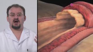 Рекомендации врача _ Варикоз и как его лечить_