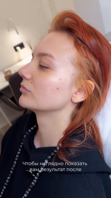 Вы будете в шоке, но у многих людей есть показания к данной процедуре