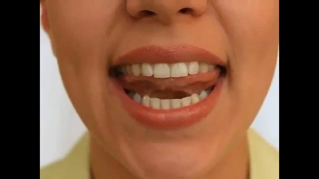 Комарик смотреть онлайн