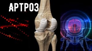 ✨ **Матрица Гаряева для лечения артроза** ✨ Эта звуковая матрица специально разработана