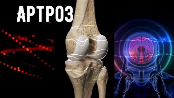 ✨ **Матрица Гаряева для лечения артроза** ✨ Эта звуковая матрица специально разработана