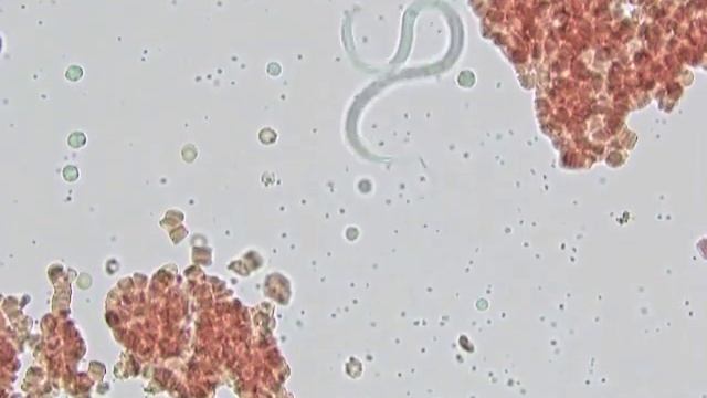 Loa loa 1 смотреть онлайн