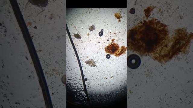 Acari dell'orecchio del gatto (otodectes cynotis) visti al microscopio (4X) смотреть онлайн