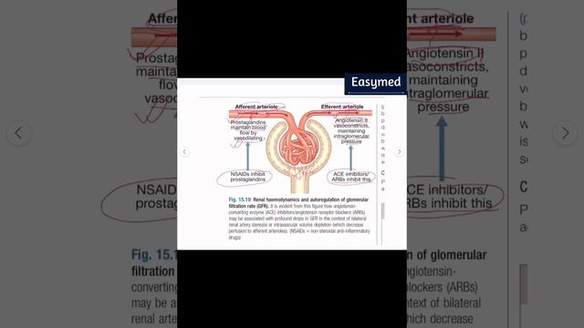 Acute kidney injury - pediatrics,Medicine | Nelson смотреть онлайн