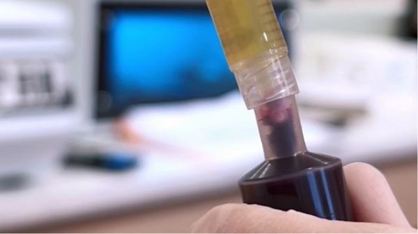 Cortexil PRP-путь к истинному
выздоровлению