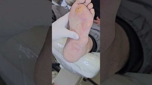 аппаратный педикюр смотреть онлайн