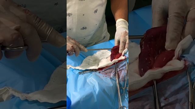 Intestinal obstruction in dog ( Silicon cake mould) смотреть онлайн