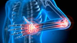 Исцеляющая Матрица Гаряева для суставов