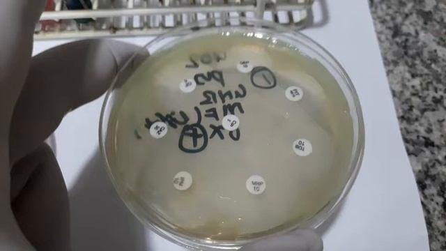 Pseudomonas colony morphology, Biochemical Tests and Antibiotics sensitivity testing смотреть онлайн