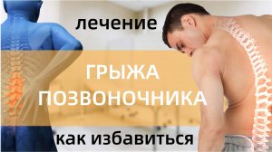 Грыжа позвоночника  Грыжа поясничного отдела позвоночника  Лечение грыжи позвоночника  Поясничная