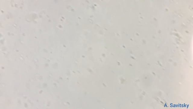 Бактерии с под ободка унитаза.   Bacteria From Under The Rim Of The Toilet