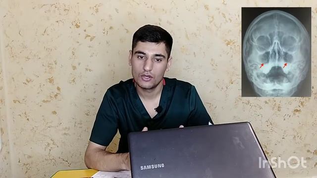 Гайморит: сабабҳояш ва табобаташ. سینوزیت علت و معالجه. Sinusit.  Sabab Va Davolash.