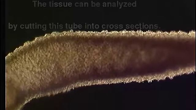 Hydra - Tissue Stretcher смотреть онлайн
