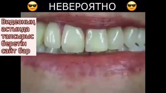 Тіс тазалау әдістері