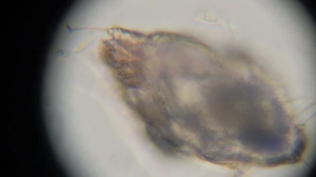 Scabies Mite From A Skin Scrapping On An Itchy Dog