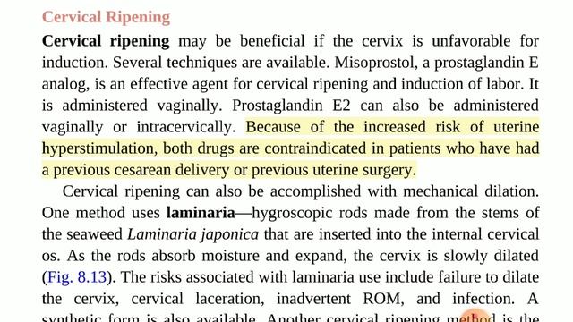 |Cervical Ripening||Bechman And Ling,s Gynecology|