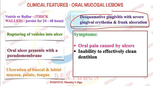 Pemphigoid Part1| Mucous Membrane Pemphigoid | Cicatricial Pemphigoid | Ocular Pemphigoid смотреть онлайн