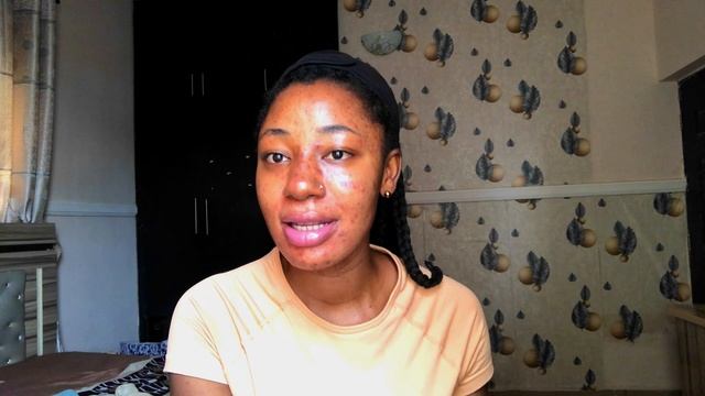 Fighting Acne: Postpartum Skincare Routine with Tretinoin Gel #skincare #tretinoin #acne смотреть онлайн