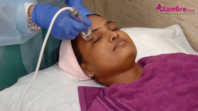 Meso Cocktail Skin Whitening and Brightening Treatment - Glamore Clinic смотреть онлайн