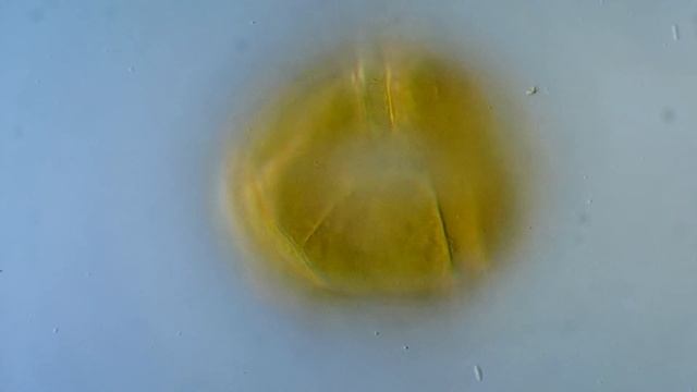 Peridinium - Dinoflagellate смотреть онлайн