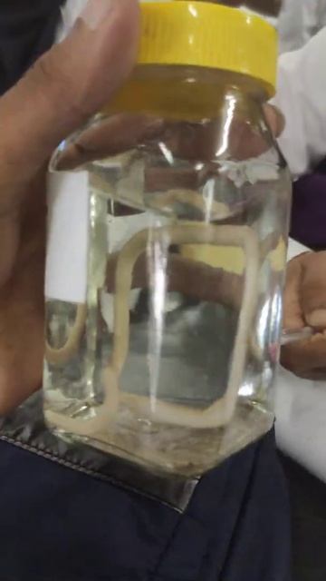 Toxocara vitulorum смотреть онлайн