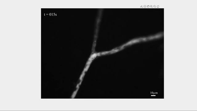 Rhizophagus irregularis C2 hyphal network - lipids stained with Nile Red. AMF_VU смотреть онлайн
