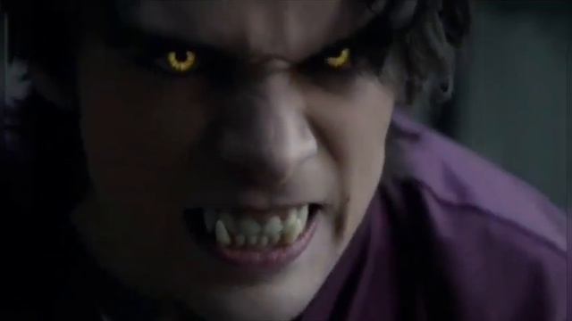 Liam Dunbar - Cage The Beast