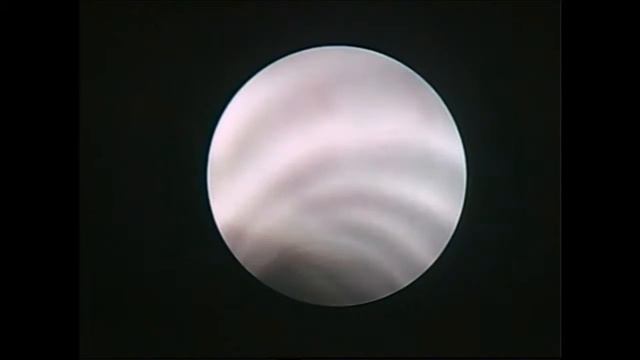 Капский варан (Varanus Exanthematicus) диагностическая трахеоскопия