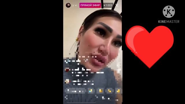 JASMIN TRANS KO’TINI APERATSIYA QILDIRMOQCHIMI...