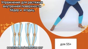 Растяжка для варусной деформации стоп