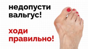 Шишка на большом пальце, как не допустить?