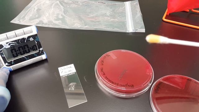 Microbiology: Translated Propionibacterium Acnes Biochemical Testing & Colonial Growth