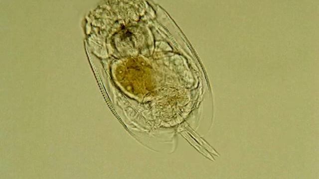 Euchlanis Dilatata