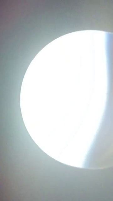 Ectoparasites from a rescued dog