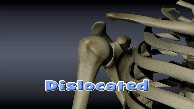 Shoulder Dislocation смотреть онлайн