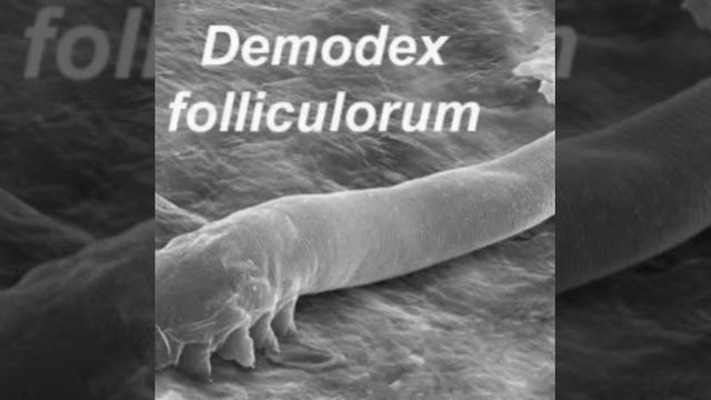 ये परजीवी अक्सर इंसान के शरीर में पाया जाता है।😱😱😱#shorts