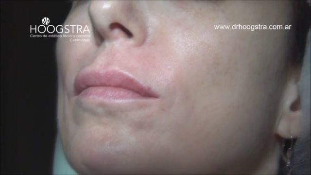 Labios: como podemos conseguir que luzcan naturales y sensuales смотреть онлайн