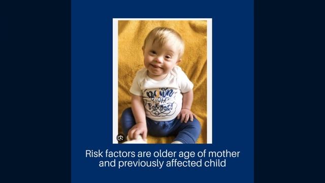 What is Down Syndrome? Causes and Risk Factors смотреть онлайн