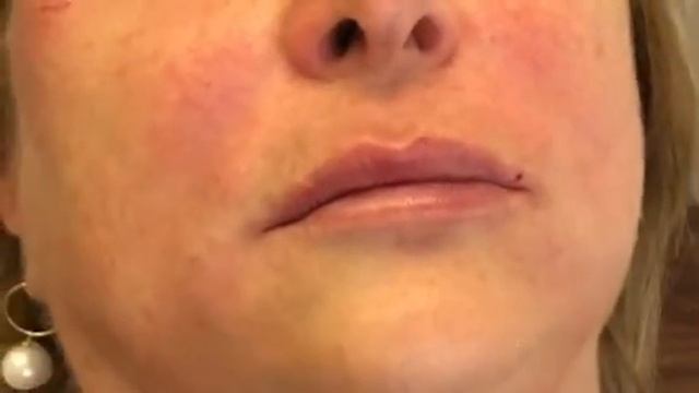 Lip pop using PDO threads смотреть онлайн